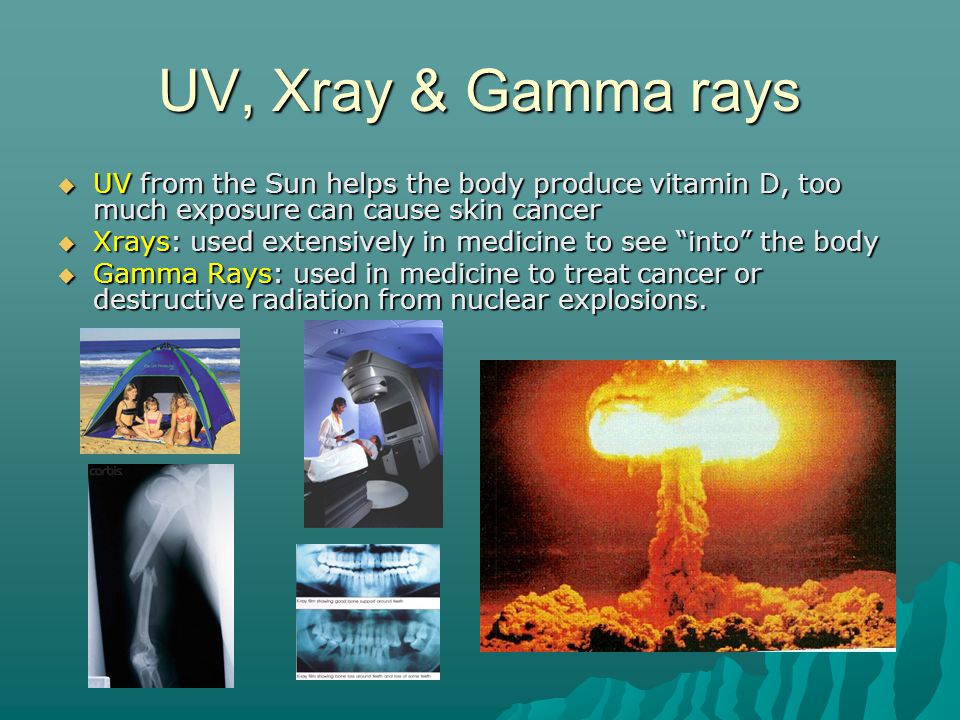 UV, Xray & Gamma rays  UV from the Sun helps the body produce vitamin D, too much exposure can cause skin cancer  Xrays: used extensively in medicine to see into the body  Gamma Rays: used in medicine to treat cancer or destructive radiation from nuclear explosions.