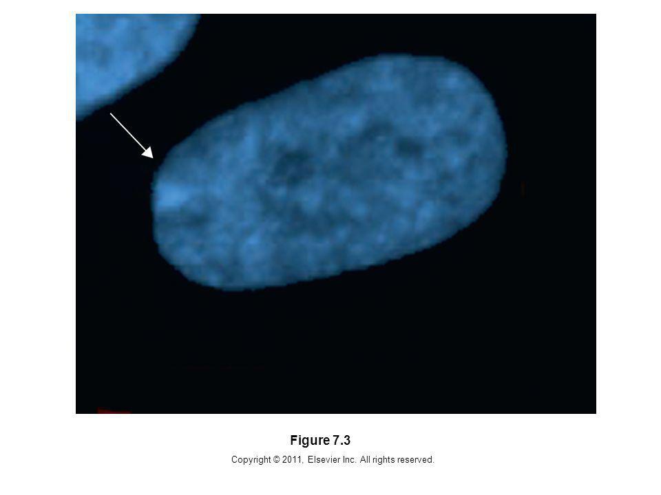 Copyright © 2011, Elsevier Inc. All rights reserved. Figure 7.3