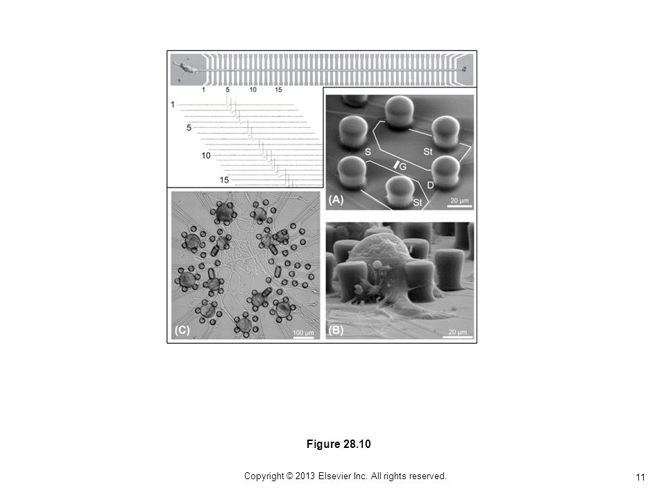 11 Copyright © 2013 Elsevier Inc. All rights reserved. Figure 28.10