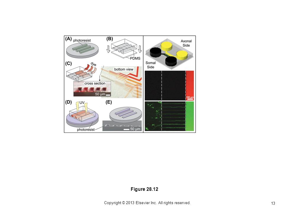 13 Copyright © 2013 Elsevier Inc. All rights reserved. Figure 28.12