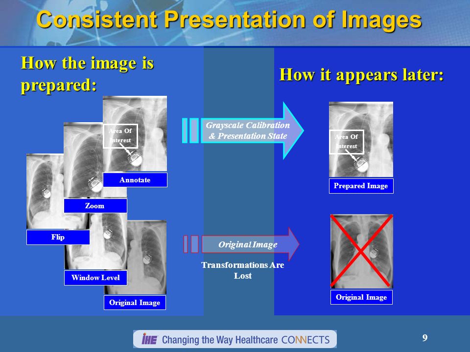 9 How the image is prepared: How it appears later: Grayscale Calibration & Presentation State Original Image Window Level Flip Zoom Area Of Interest Annotate Transformations Are Lost Original Image Area Of Interest Prepared Image Original Image Consistent Presentation of Images