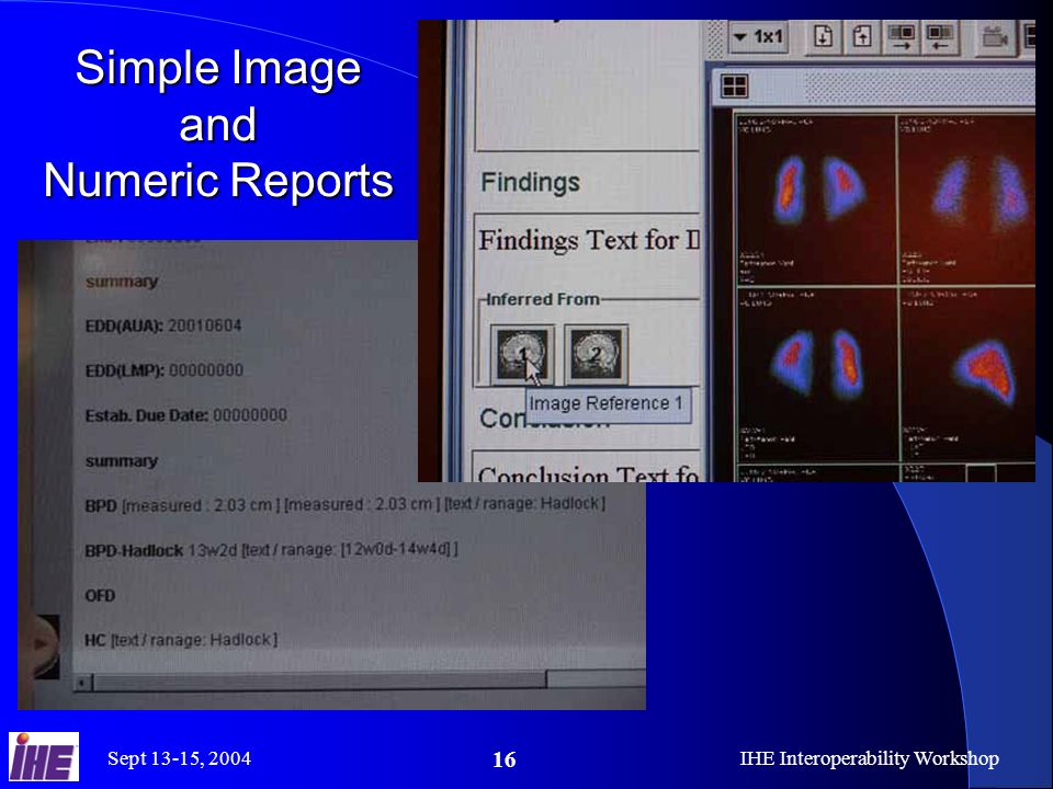 Sept 13-15, 2004IHE Interoperability Workshop 16 Simple Image and Numeric Reports