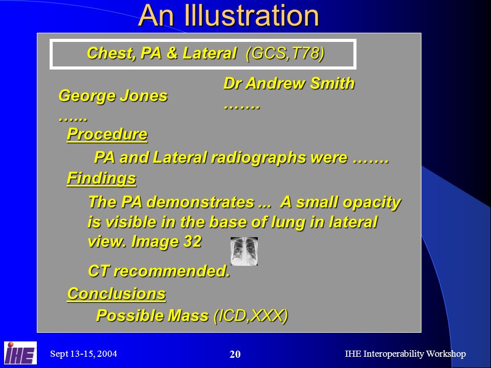 Sept 13-15, 2004IHE Interoperability Workshop 20 An Illustration Chest, PA & Lateral (GCS,T78) Chest, PA & Lateral (GCS,T78) Procedure PA and Lateral radiographs were …….