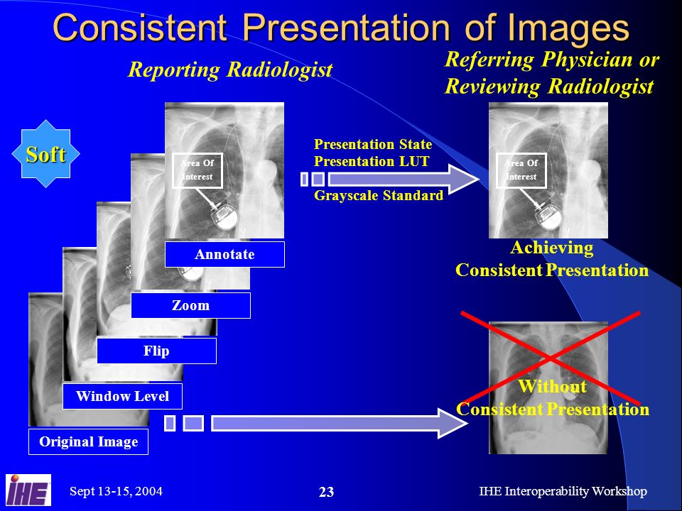 Sept 13-15, 2004IHE Interoperability Workshop 23 Consistent Presentation of Images Reporting Radiologist Referring Physician or Reviewing Radiologist Presentation State Presentation LUT Grayscale Standard Original ImageWindow LevelFlip Zoom Area Of Interest Annotate Without Consistent Presentation Achieving Consistent Presentation Area Of Interest Soft