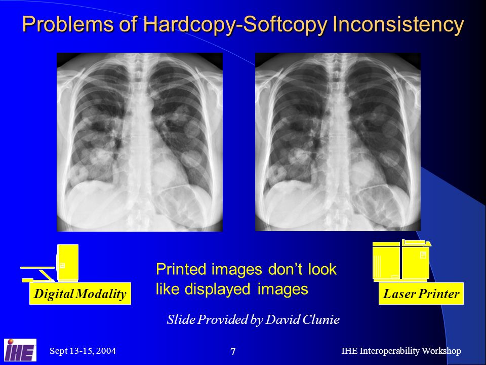 Sept 13-15, 2004IHE Interoperability Workshop 7 Problems of Hardcopy-Softcopy Inconsistency Digital Modality Laser Printer Printed images dont look like displayed images Slide Provided by David Clunie