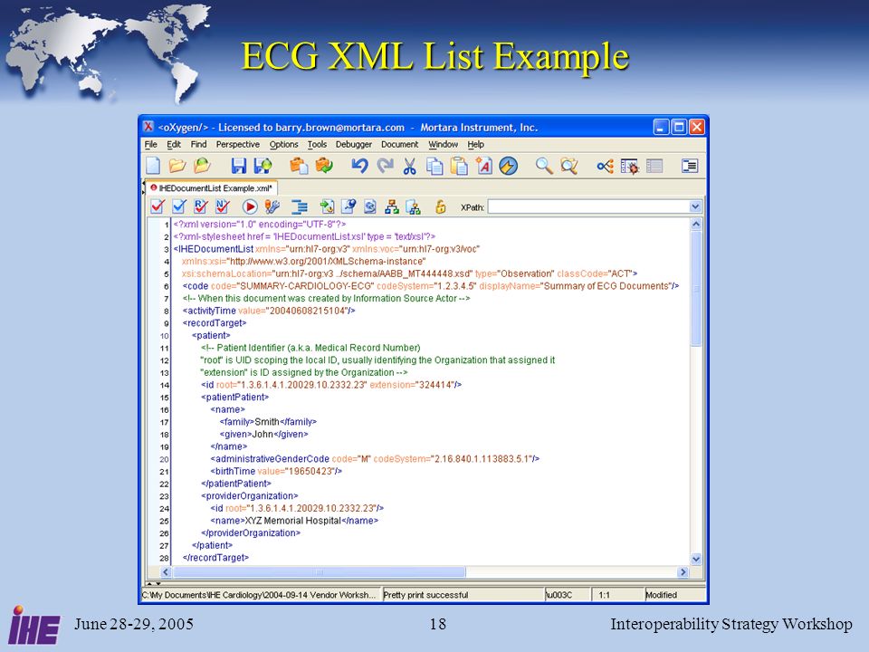 June 28-29, 2005Interoperability Strategy Workshop18 ECG XML List Example