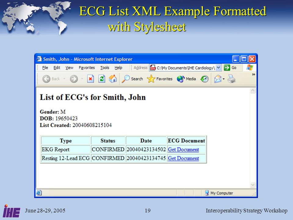 June 28-29, 2005Interoperability Strategy Workshop19 ECG List XML Example Formatted with Stylesheet ECG List XML Example Formatted with Stylesheet