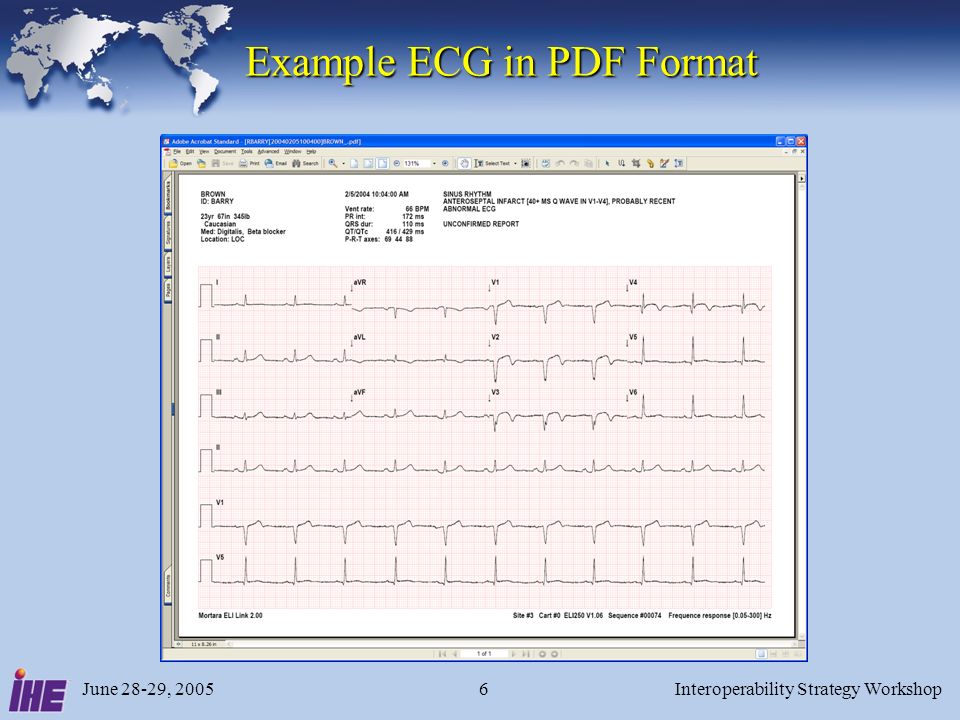 June 28-29, 2005Interoperability Strategy Workshop6 Example ECG in PDF Format Example ECG in PDF Format