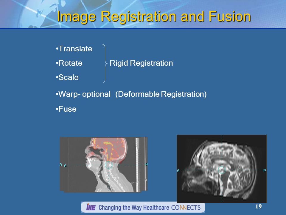 19 Image Registration and Fusion Translate Rotate Rigid Registration Scale Warp- optional (Deformable Registration) Fuse