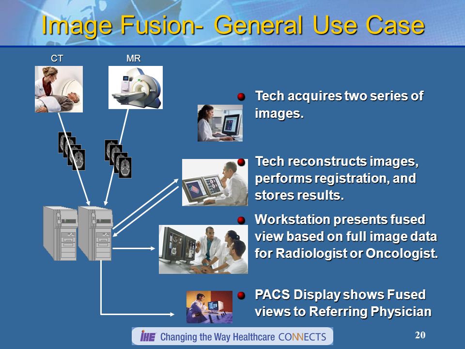20 Image Fusion- General Use Case Tech acquires two series of images.
