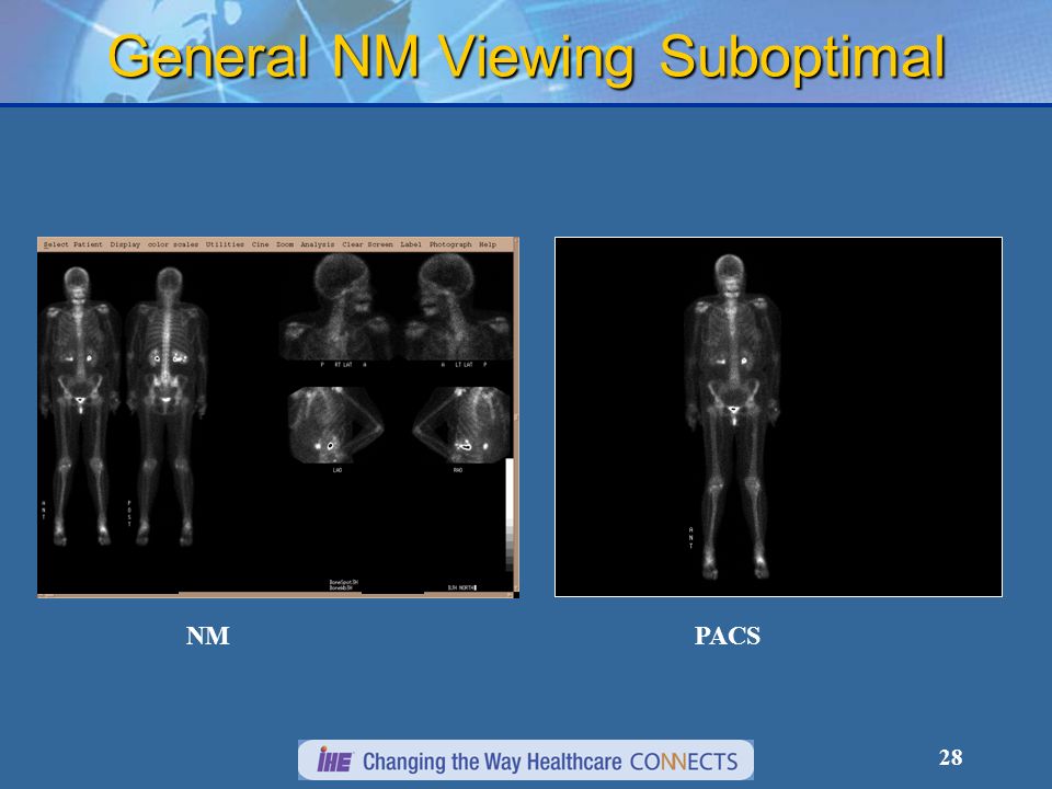 28 General NM Viewing Suboptimal NMPACS
