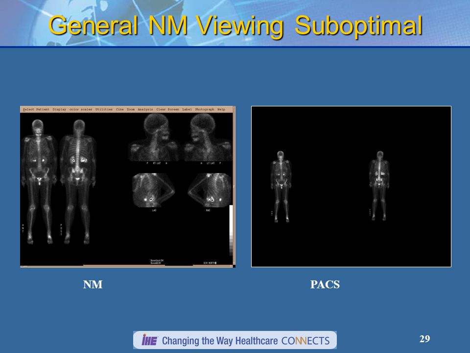 29 General NM Viewing Suboptimal NMPACS