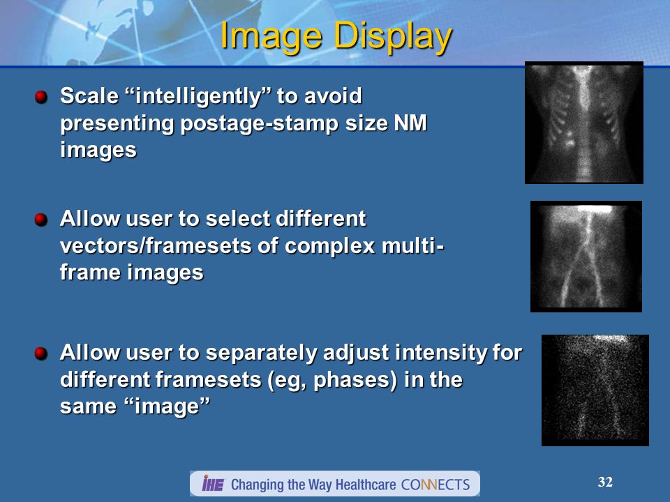 32 Image Display Scale intelligently to avoid presenting postage-stamp size NM images Allow user to select different vectors/framesets of complex multi- frame images Allow user to separately adjust intensity for different framesets (eg, phases) in the same image