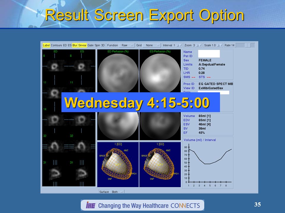 35 Result Screen Export Option Wednesday 4:15-5:00