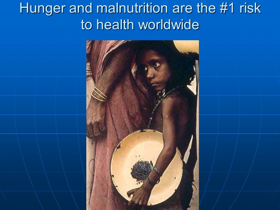 Hunger and malnutrition are the #1 risk to health worldwide