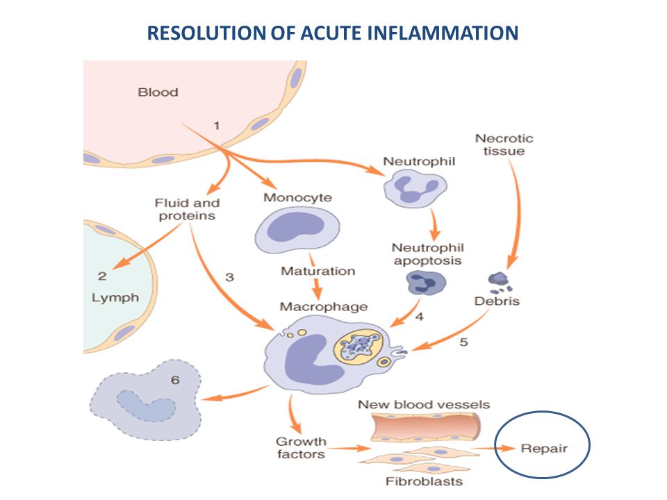 RESOLUTION OF ACUTE INFLAMMATION