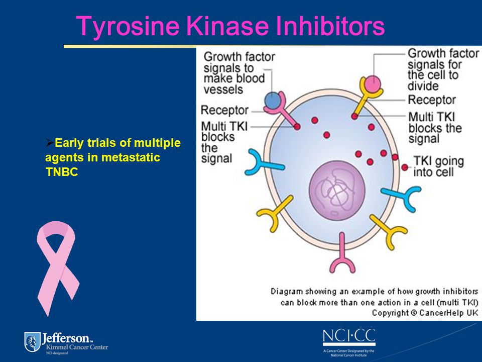 Tyrosine Kinase Inhibitors  Early trials of multiple agents in metastatic TNBC