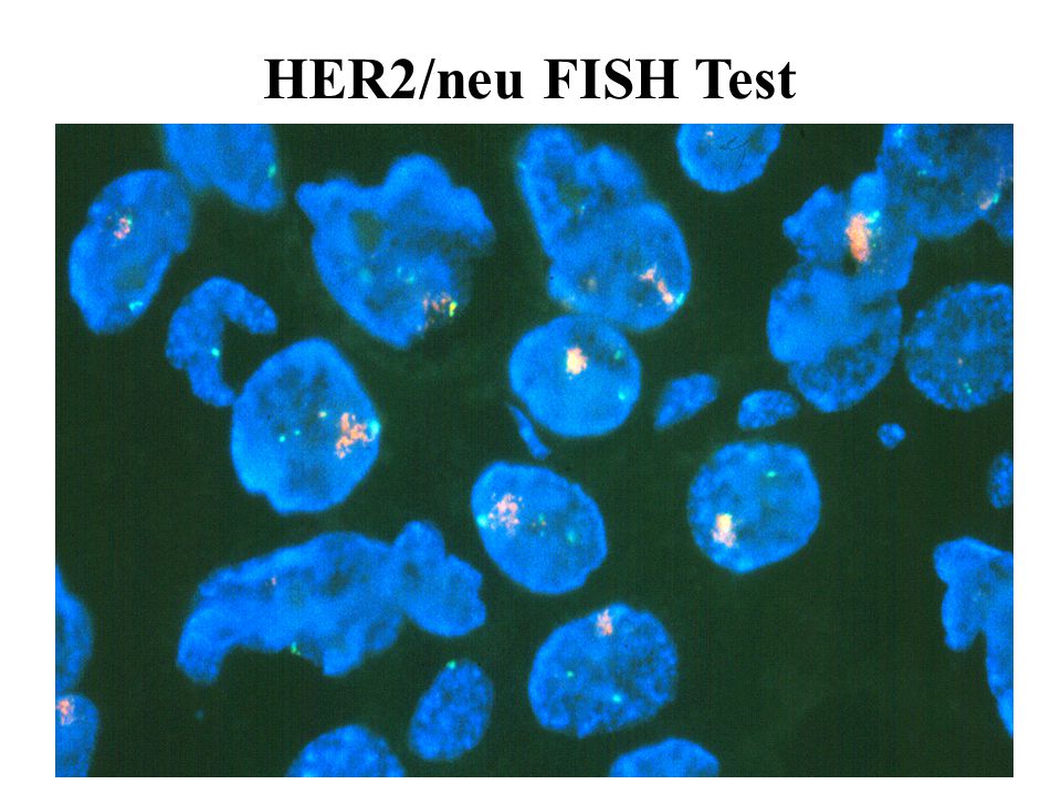 HER2/neu FISH Test