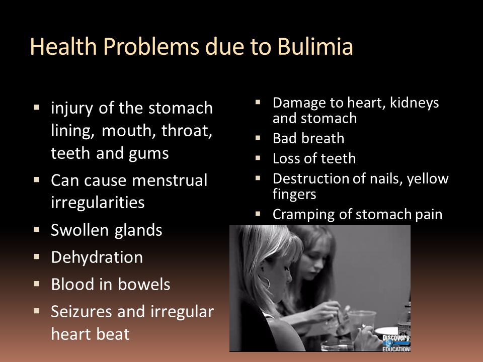 Health Problems due to Bulimia  injury of the stomach lining, mouth, throat, teeth and gums  Can cause menstrual irregularities  Swollen glands  Dehydration  Blood in bowels  Seizures and irregular heart beat  Damage to heart, kidneys and stomach  Bad breath  Loss of teeth  Destruction of nails, yellow fingers  Cramping of stomach pain