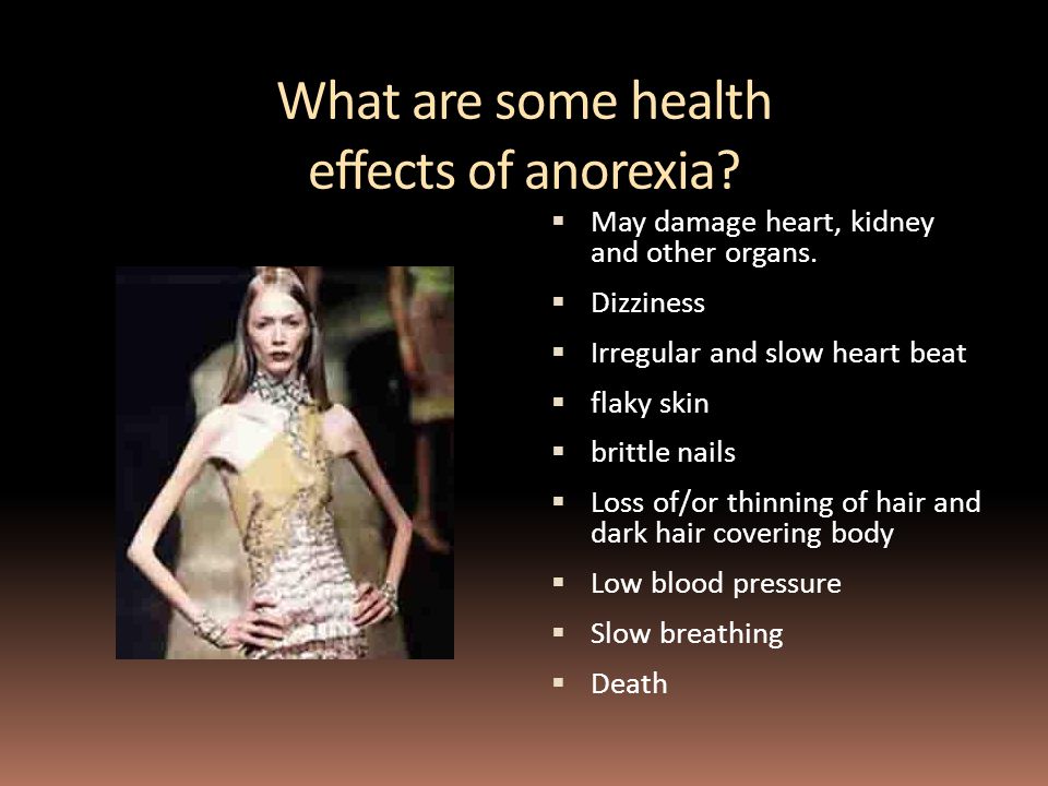 What are some health effects of anorexia.  May damage heart, kidney and other organs.