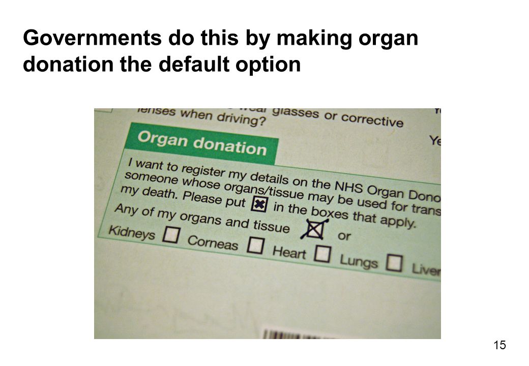 Governments do this by making organ donation the default option 15