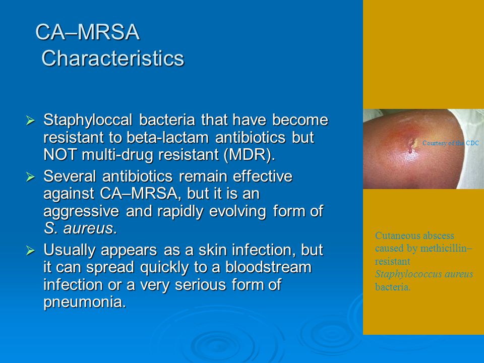 Mrsa Definition Methicillin Resistant Staphylococcus Aureus Mrsa Is A Bacterium Responsible For Difficult To Treat Infections In Humans Mrsa Is By Definition Ppt Download