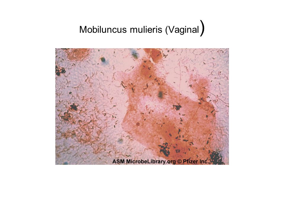 mobiluncus en vagina Mobiluncus en vagina