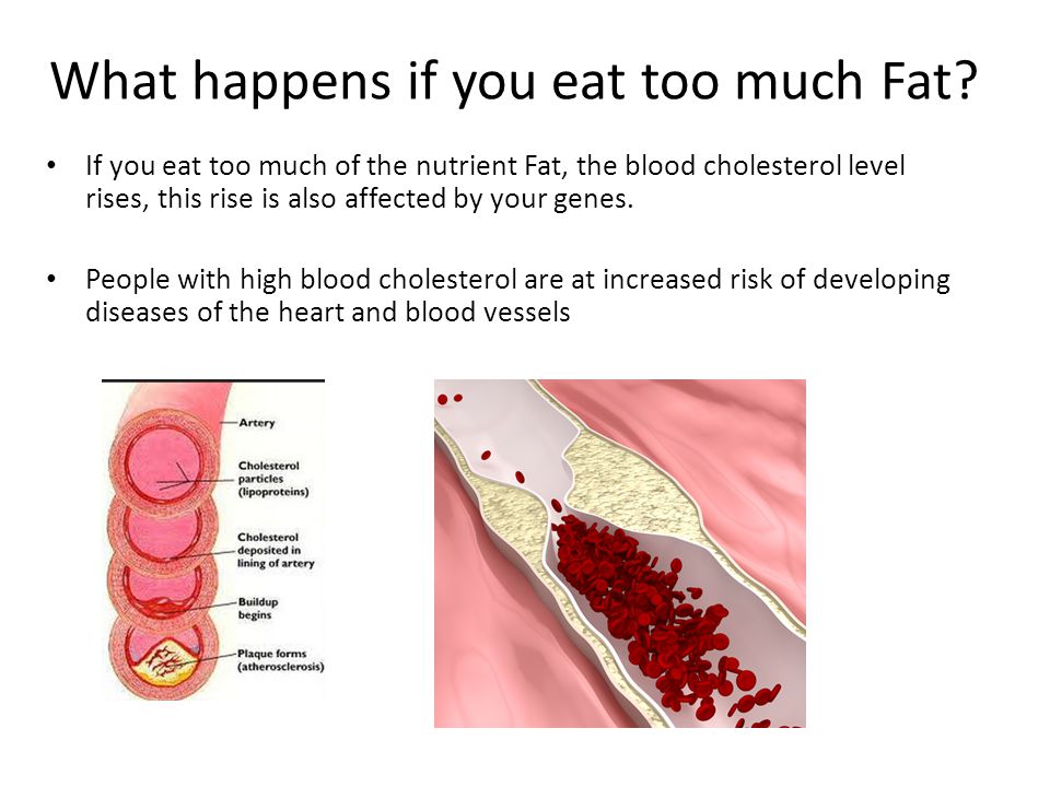 What happens if you eat too much Fat.