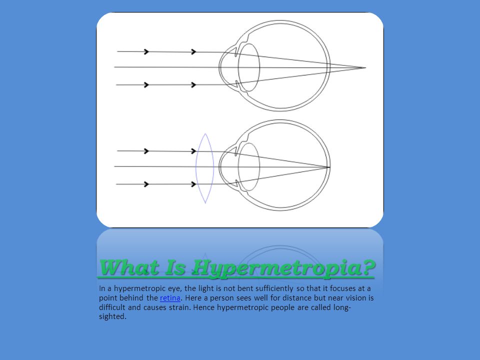 What Is Hypermetropia.