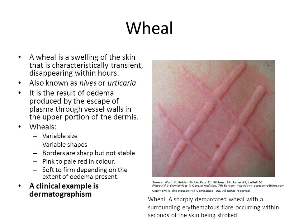 Dermatological History and Examination. History of a rash Key questions: –  When did it start? – Does it itch, burn, or hurt? – Where on the body did  it. - ppt download