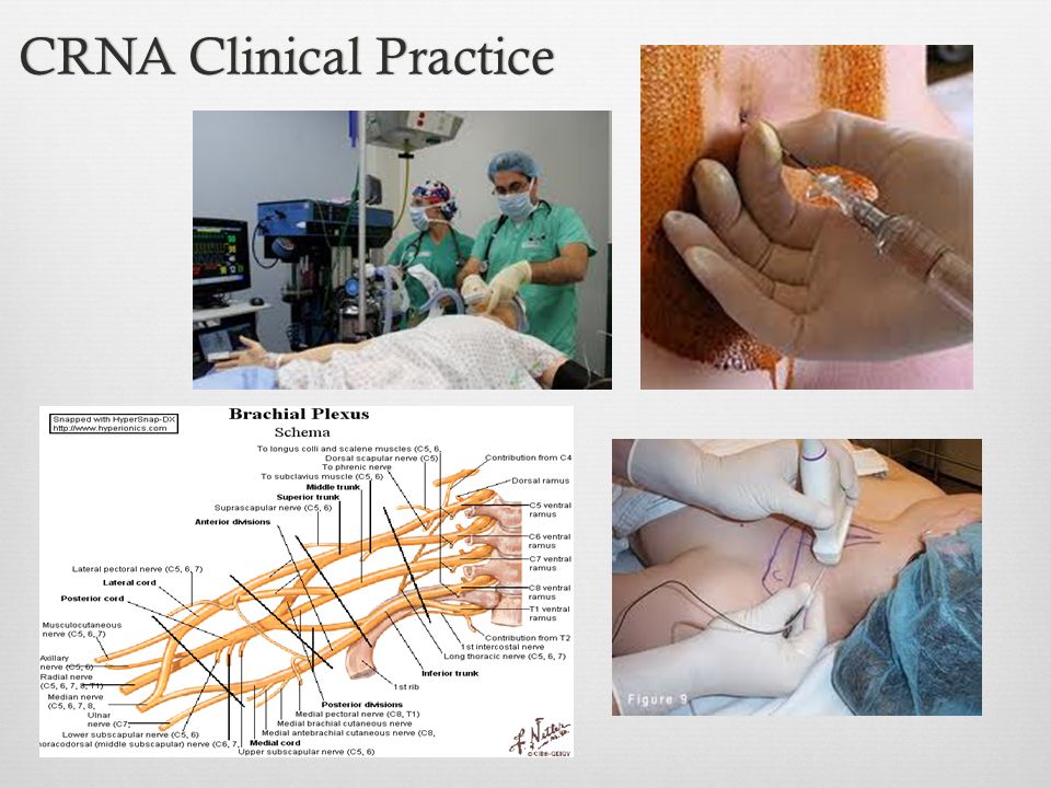 CRNA Clinical PracticeCRNA Clinical Practice
