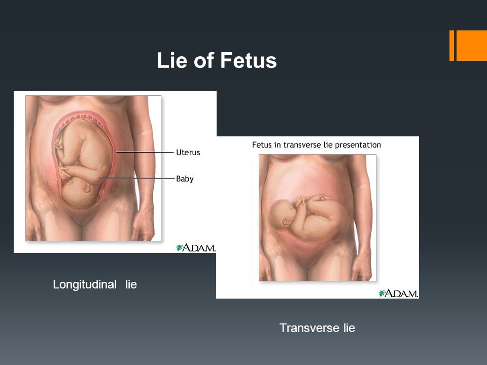 Lie of Fetus Longitudinal lie Transverse lie