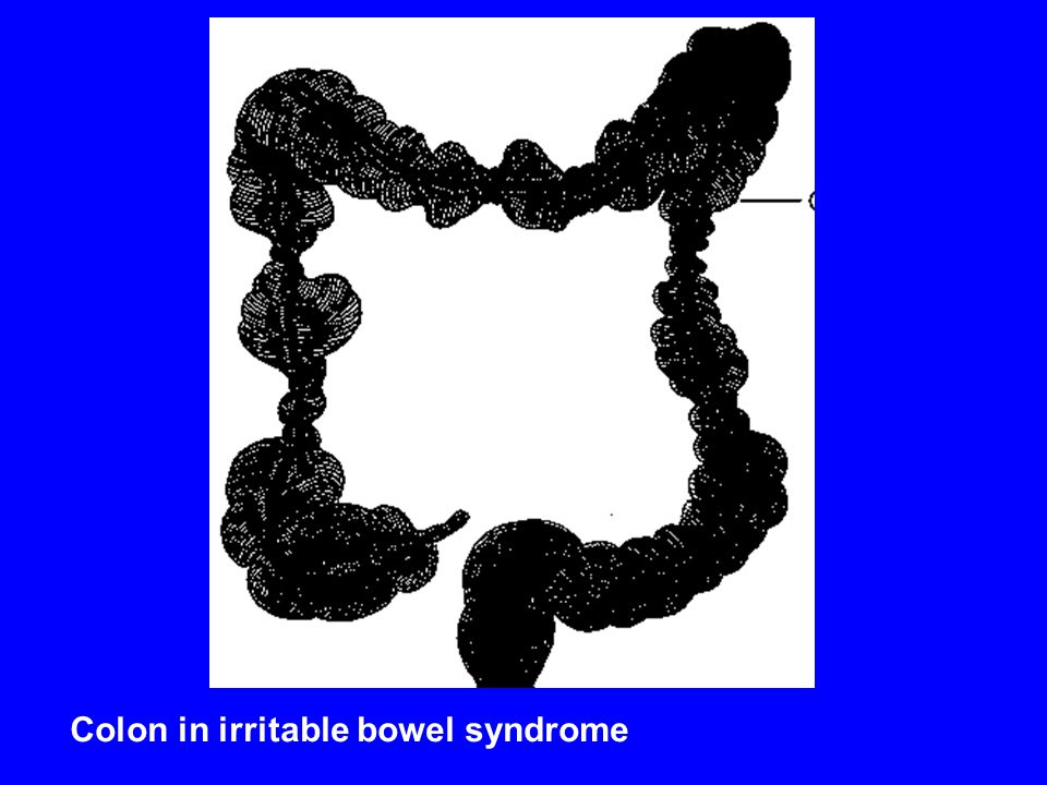 Colon in irritable bowel syndrome