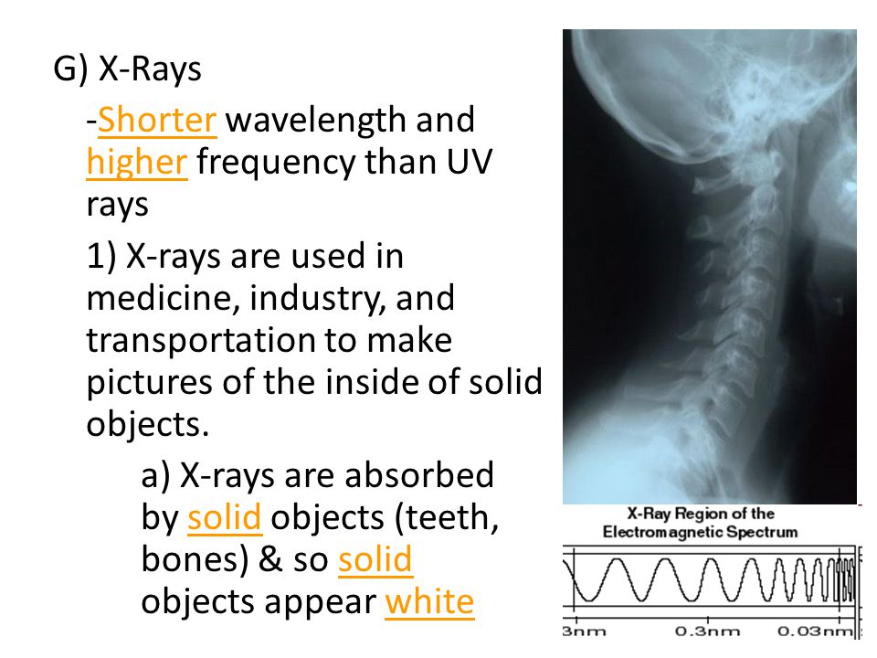 G) X-Rays -Shorter wavelength and higher frequency than UV rays 1) X-rays are used in medicine, industry, and transportation to make pictures of the inside of solid objects.