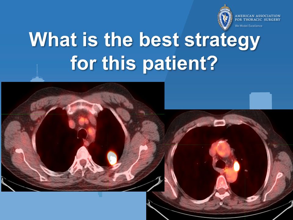 What is the best strategy for this patient