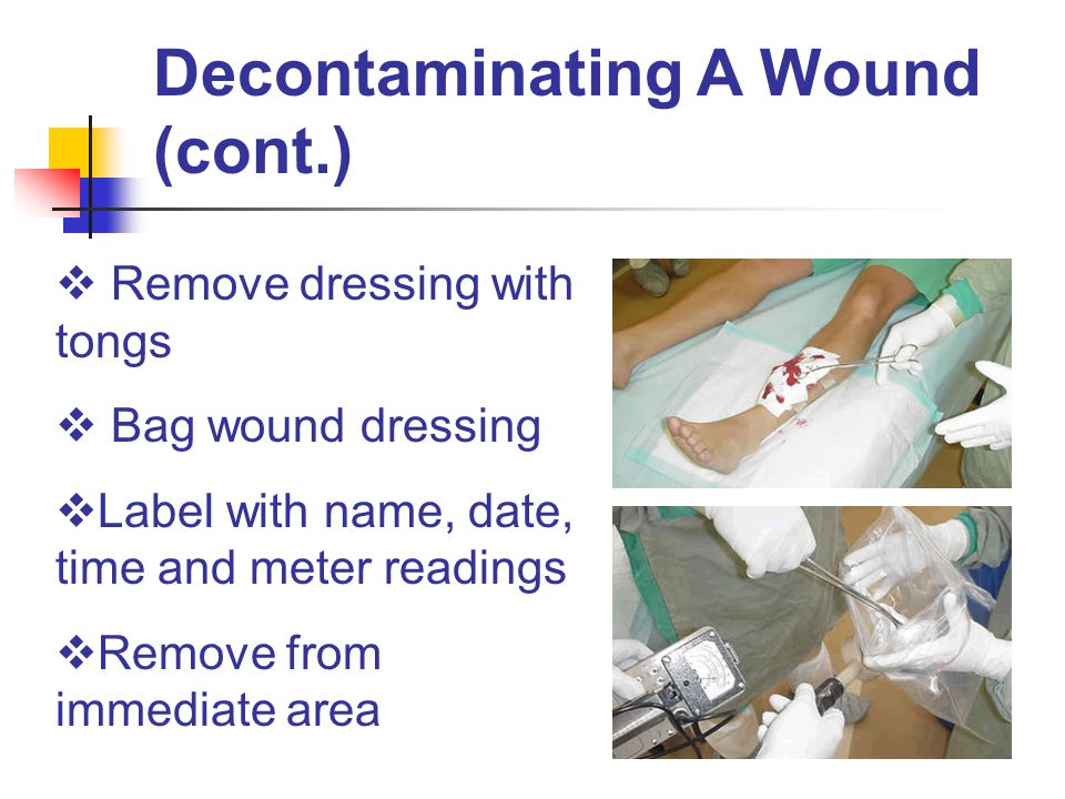 Decontaminating A Wound (cont.)  Remove dressing with tongs  Bag wound dressing  Label with name, date, time and meter readings  Remove from immediate area