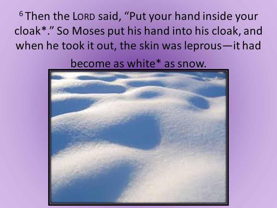 6 Then the L ORD said, Put your hand inside your cloak*. So Moses put his hand into his cloak, and when he took it out, the skin was leprous—it had become as white* as snow.
