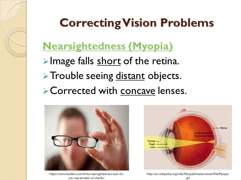 myopia teszt einstein