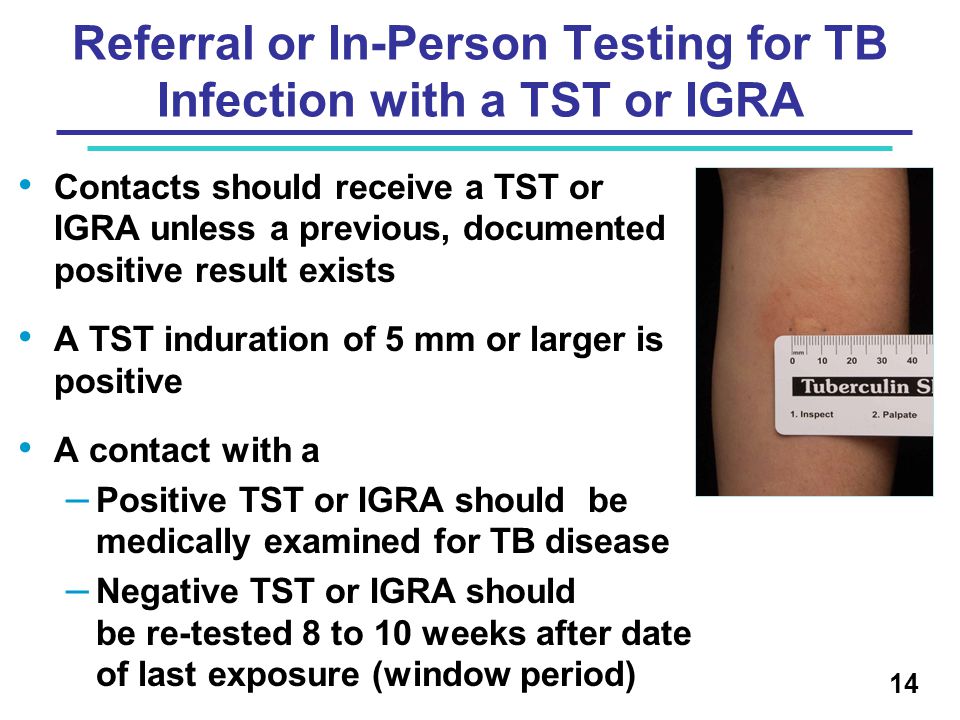 Contacts should receive a TST or IGRA unless a previous, documented positive result exists A TST induration of 5 mm or larger is positive A contact with a – Positive TST or IGRA should be medically examined for TB disease – Negative TST or IGRA should be re-tested 8 to 10 weeks after date of last exposure (window period) 14 Referral or In-Person Testing for TB Infection with a TST or IGRA