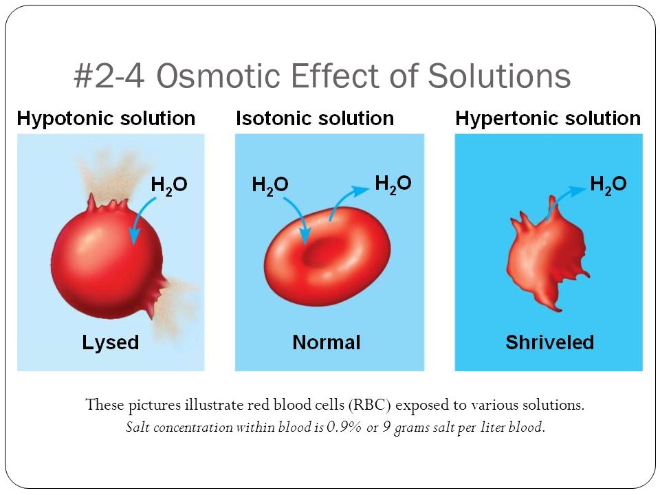 #2-4 Osmotic Effect of Solutions These pictures illustrate red blood cells (RBC) exposed to various solutions.