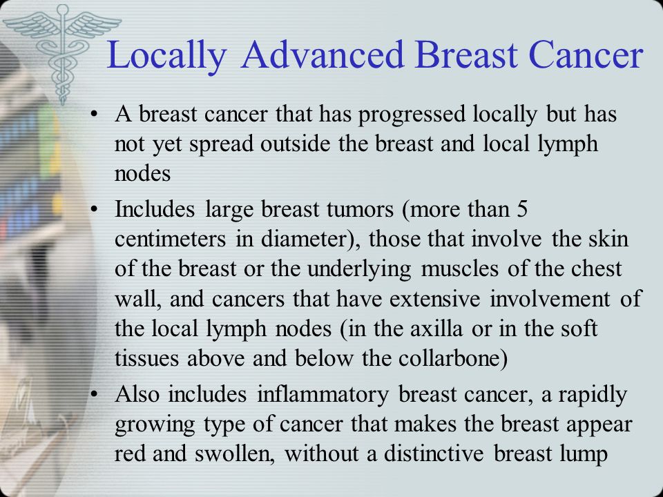 Locally Advanced Breast Cancer A breast cancer that has progressed locally but has not yet spread outside the breast and local lymph nodes Includes large breast tumors (more than 5 centimeters in diameter), those that involve the skin of the breast or the underlying muscles of the chest wall, and cancers that have extensive involvement of the local lymph nodes (in the axilla or in the soft tissues above and below the collarbone) Also includes inflammatory breast cancer, a rapidly growing type of cancer that makes the breast appear red and swollen, without a distinctive breast lump