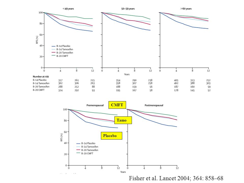 CMFT Placebo Tamo Fisher et al. Lancet 2004; 364: 858–68