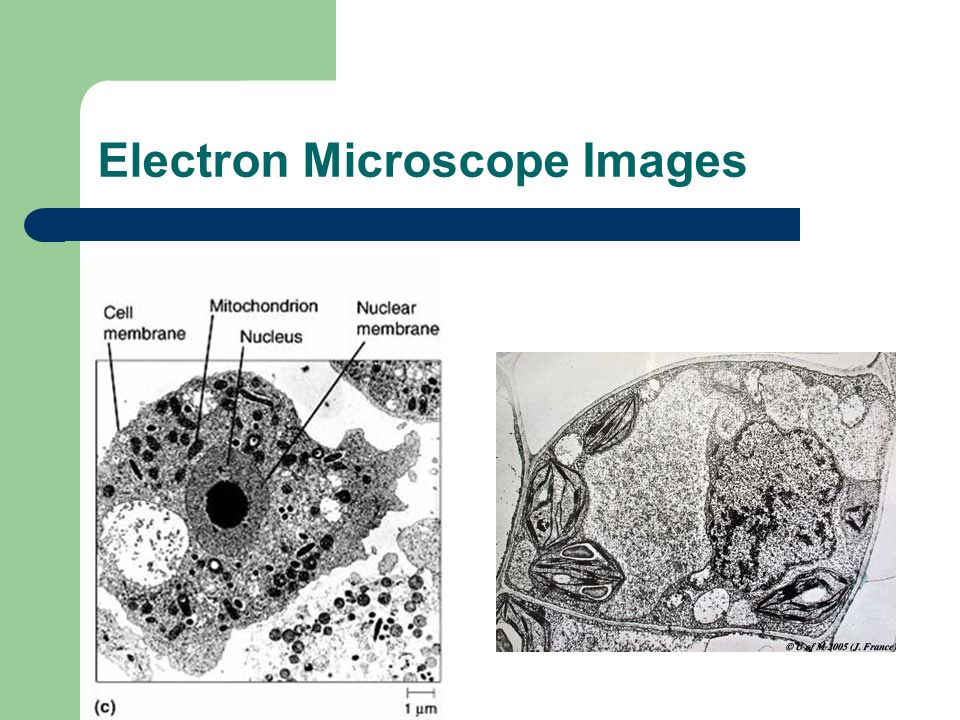 Electron Microscope Images