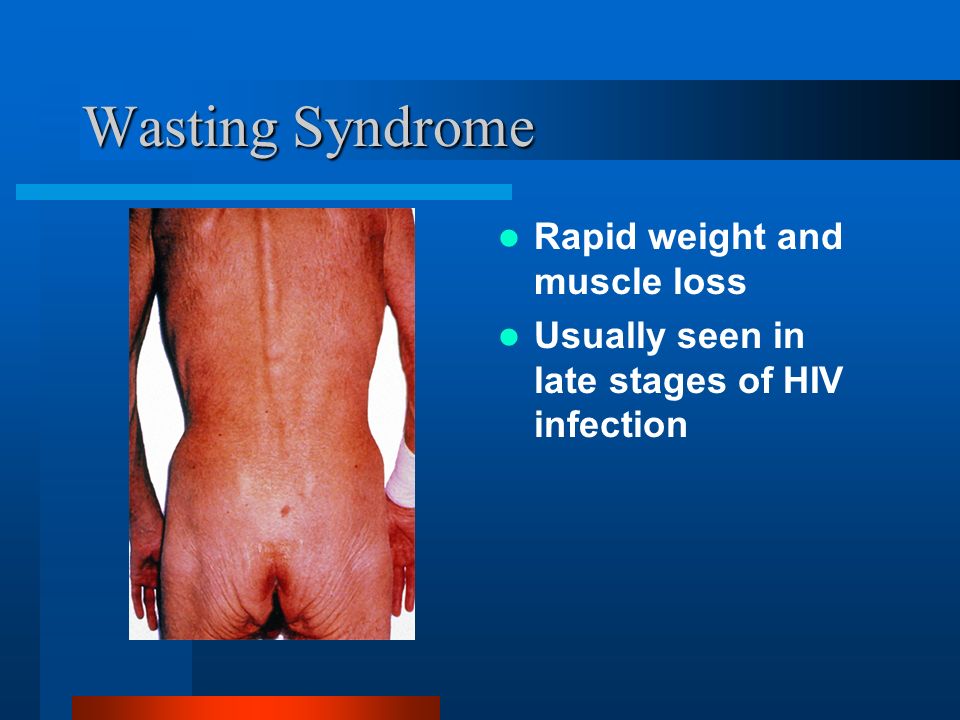 Wasting Syndrome Rapid weight and muscle loss Usually seen in late stages of HIV infection
