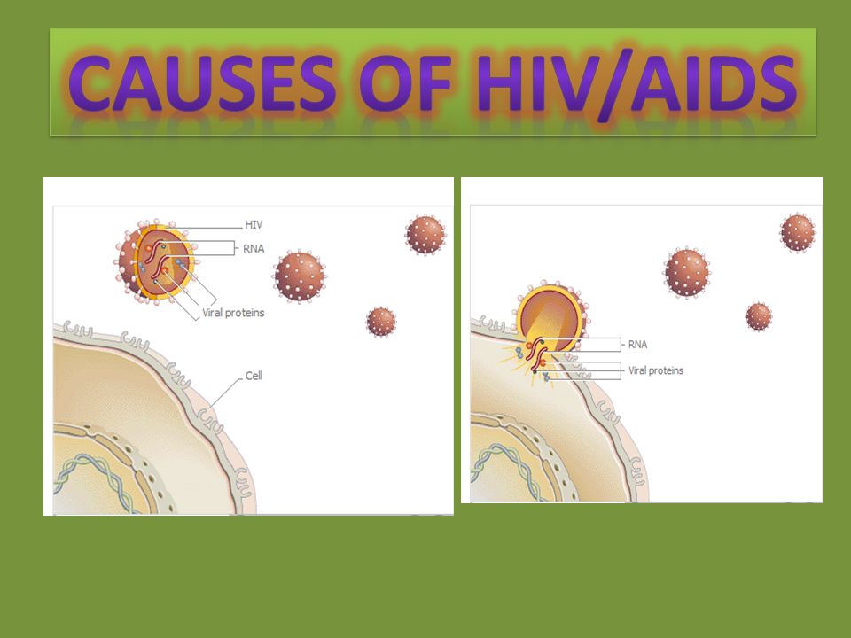 Transmission of HIV —the AIDS-causing virus—occurs most commonly as a result of sexual intercourse.
