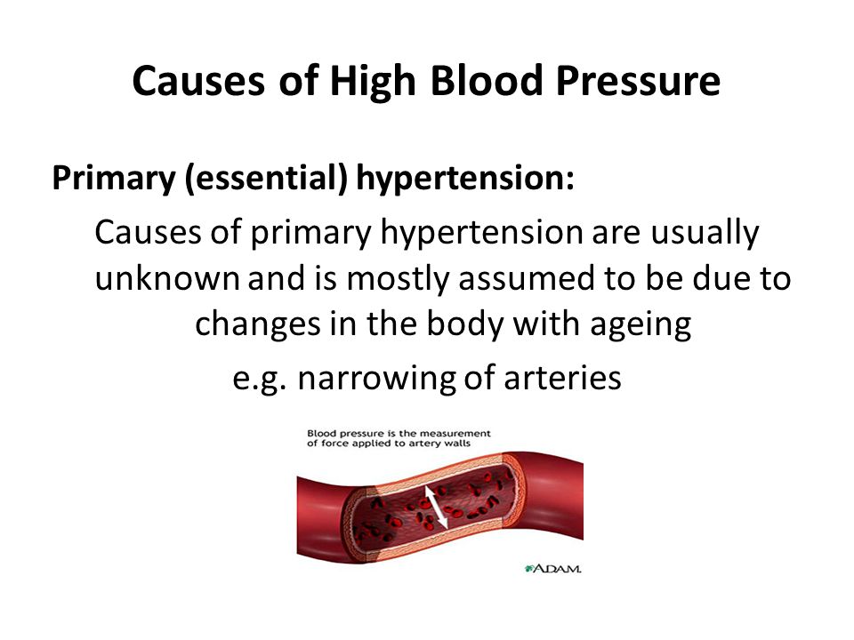 Causes of High Blood Pressure Primary (essential) hypertension: Causes of primary hypertension are usually unknown and is mostly assumed to be due to changes in the body with ageing e.g.