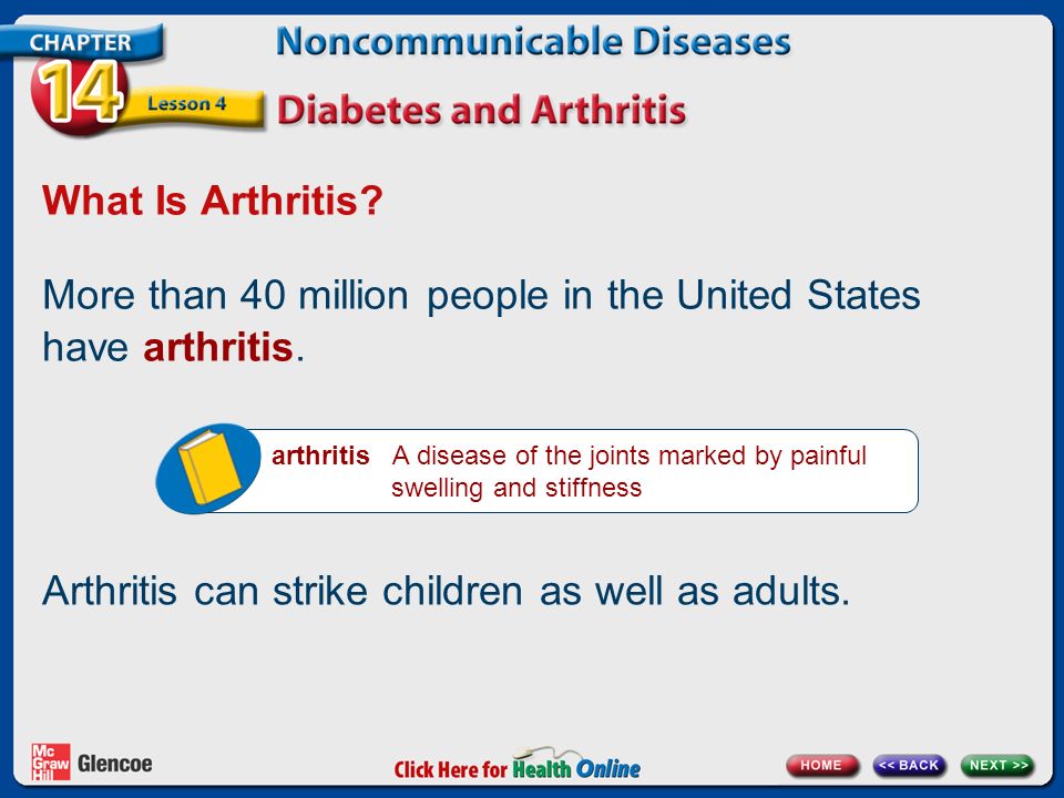 What Is Arthritis. More than 40 million people in the United States have arthritis.