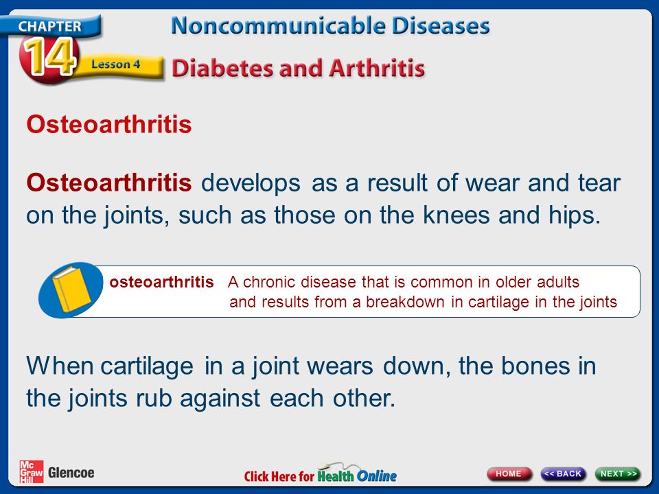 Osteoarthritis Osteoarthritis develops as a result of wear and tear on the joints, such as those on the knees and hips.