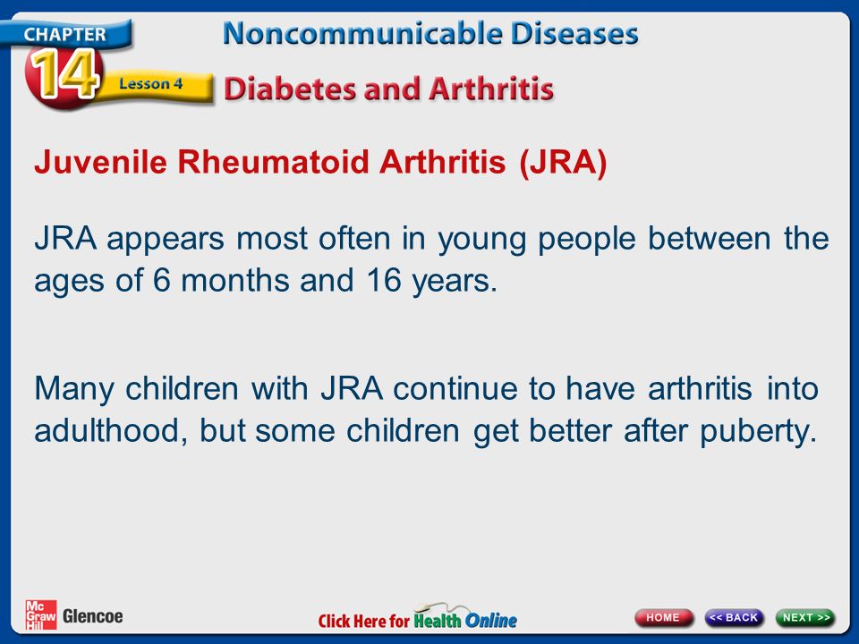 Juvenile Rheumatoid Arthritis (JRA) JRA appears most often in young people between the ages of 6 months and 16 years.