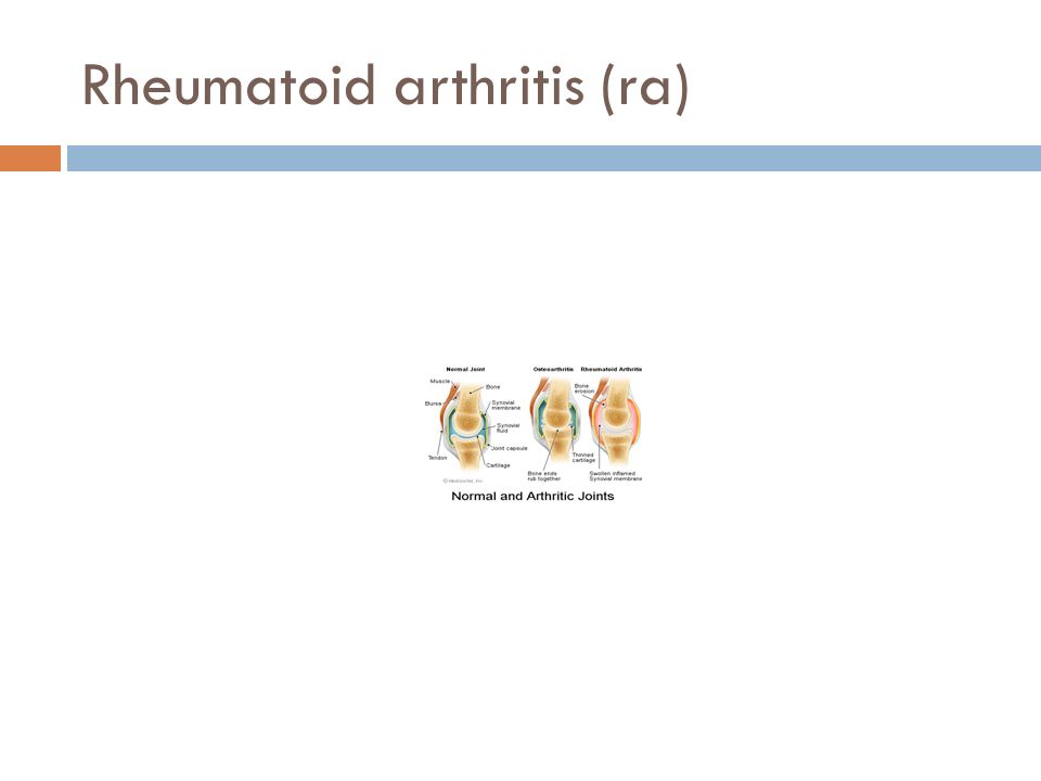 Rheumatoid arthritis (ra)
